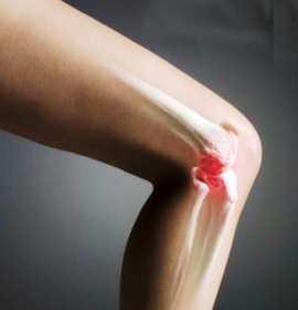 Какие причины вызывают артроз колена